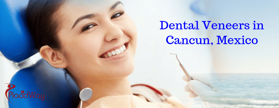 Dental Veneers in Cancun, Mexico Dental Veneers in Cancun, Mexico